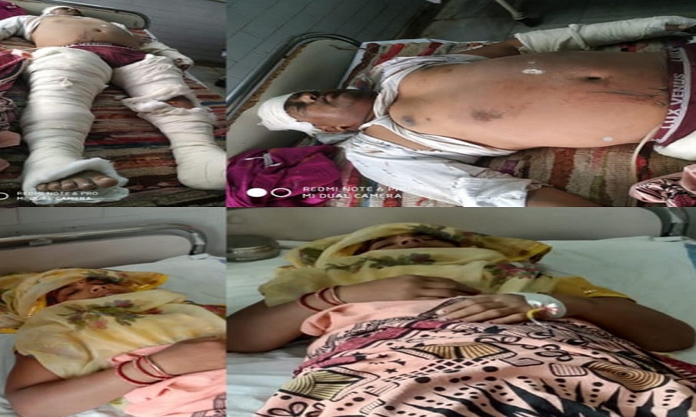 बोलेरो की टक्कर से शिक्षक-शिक्षिका घायल, शिक्षक के दोनों पैर फैक्चर : REWA NEWS